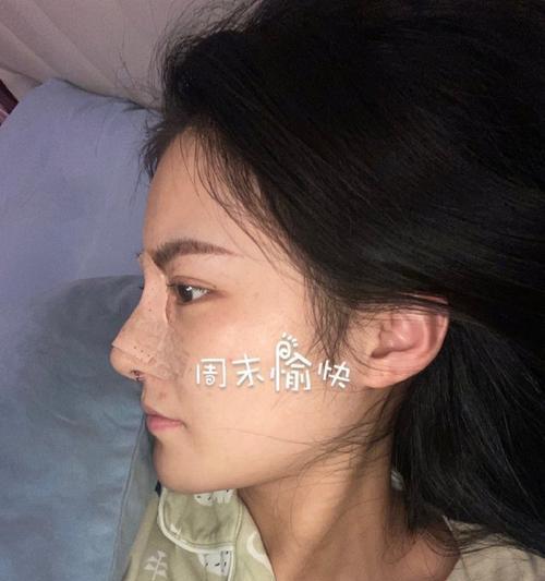 以鼻线是什么样子的？（探究不同鼻线形状的美学价值与特点）