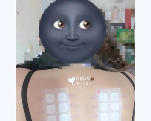 医院常用的螨虫检测方法（以检测螨虫的方法为主题，了解医院常用的检测手段）