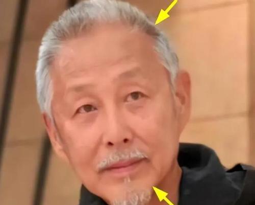 探究胡子发黄发白的原因（揭秘胡子发黄发白的真相）