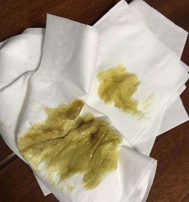 病毒侵袭人体，该挂什么药？（探索细小病毒的药物治疗之道）