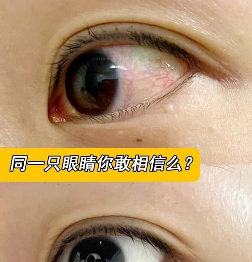 探究眼睛常见的红肿块原因（眼睛红肿块的病因及治疗方法分析）