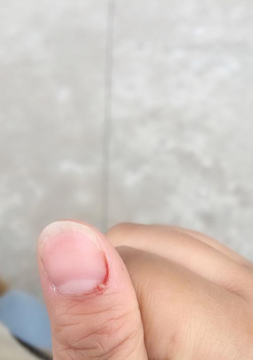 狗狗打了疫苗不出现反应的原因及重要性（了解狗狗疫苗后的安心与保障）