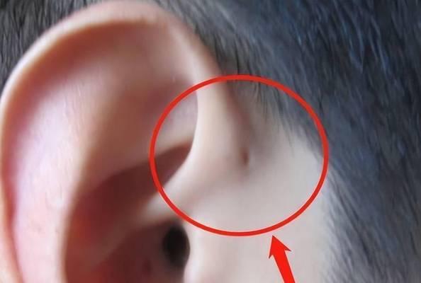 耳朵里为什么会有臭味？（探索耳朵内部的臭味源及预防方法）