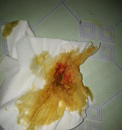 狗狗拉稀不吐的原因（探究狗狗拉稀而不吐的背后原因）