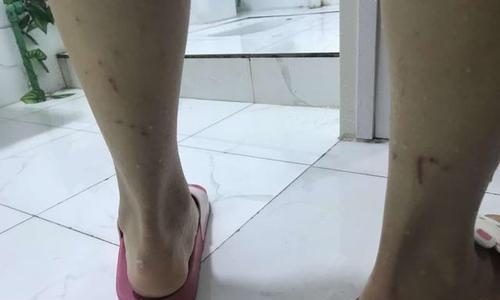 揭秘狗咬裤子背后的原因（为什么狗会咬裤子？探寻背后的心理与行为动机）
