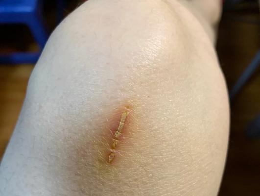 小狗打完疫苗后多久可以洗澡？（了解合适的洗澡时间，宠物健康无忧）