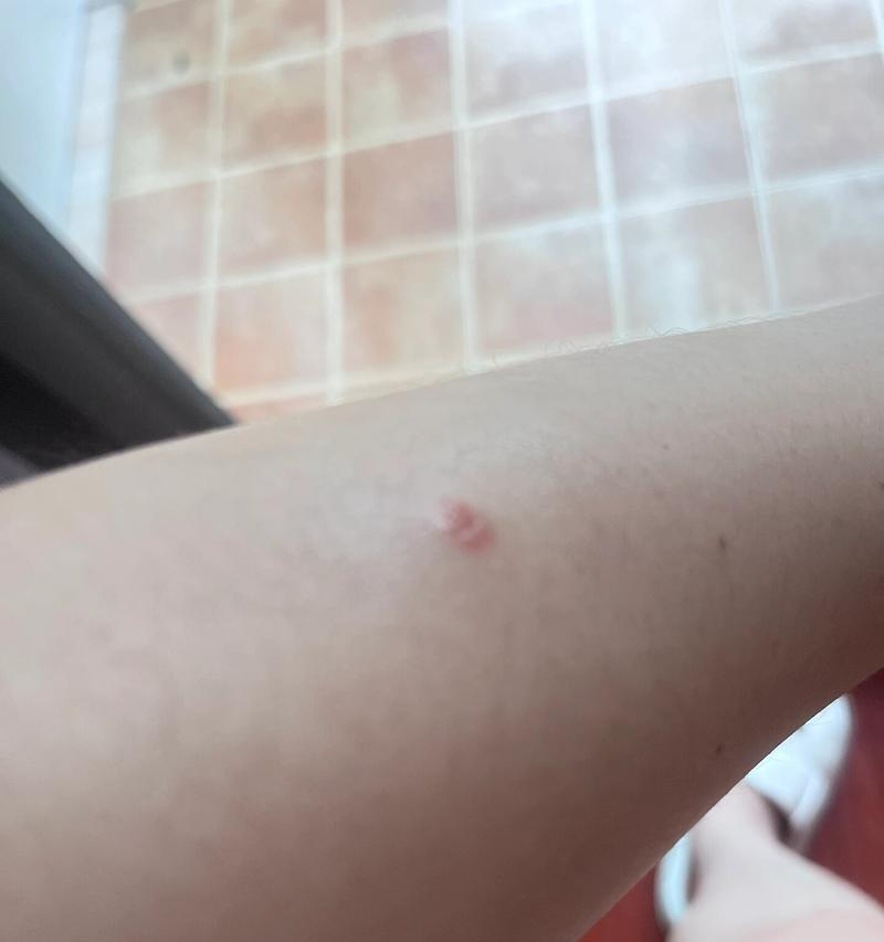 狗狗长癣的康复时间及治疗方法（探讨狗狗癣症疗程及有效治疗手段）
