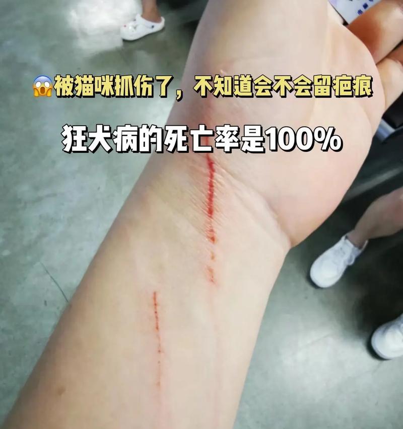 猫抓伤引发的疾病及预防措施（小心猫爪的健康隐患，预防胜于治疗）