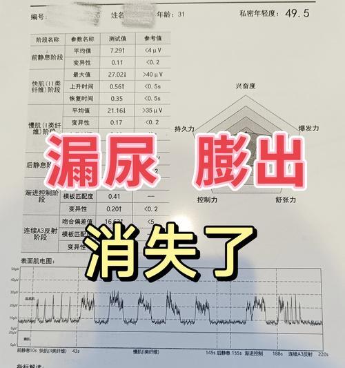 顺产前的症状揭秘（了解这些症状，顺利迎接宝宝的到来）