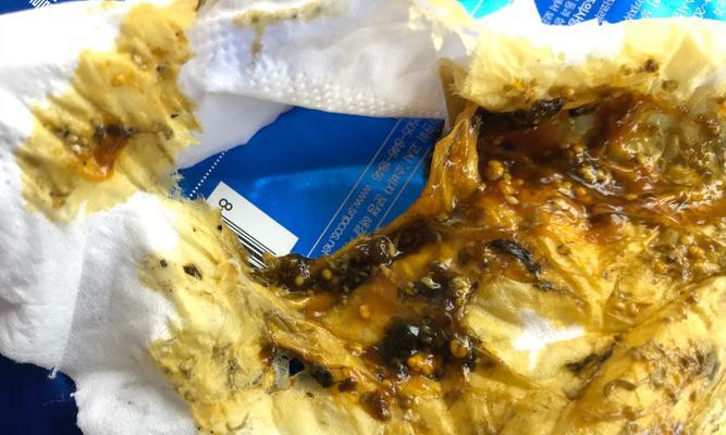 狗狗大便虫卵的生存周期（探究狗狗大便虫卵在不同环境下的存活时间）