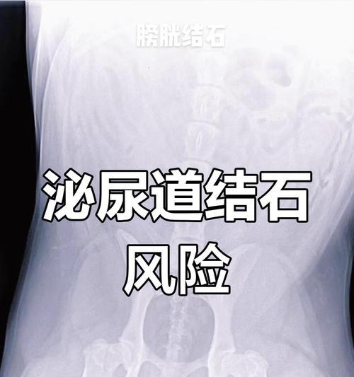 探讨狗狗膀胱问题的原因与治疗方法（了解狗狗膀胱问题及其对犬类健康的影响）