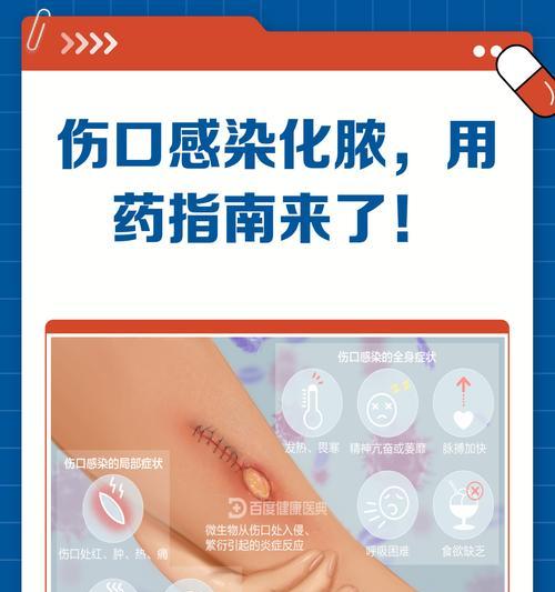 治疗伤口总化脓的方法与注意事项（预防伤口感染，合理处理脓液，促进伤口愈合）