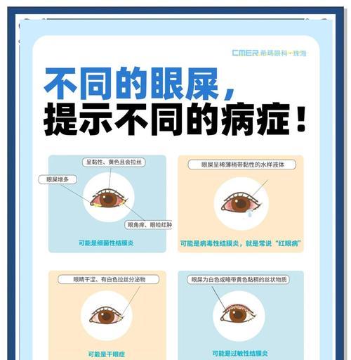 猫咪眼屎问题解析（眼屎是上火引起的吗？探讨猫咪眼屎问题的原因和解决方法）